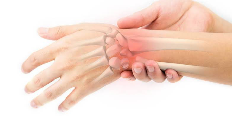 Metode untuk Menyembuhkan Penyakit Gangguan Tulang Tangan dan Pergelangan